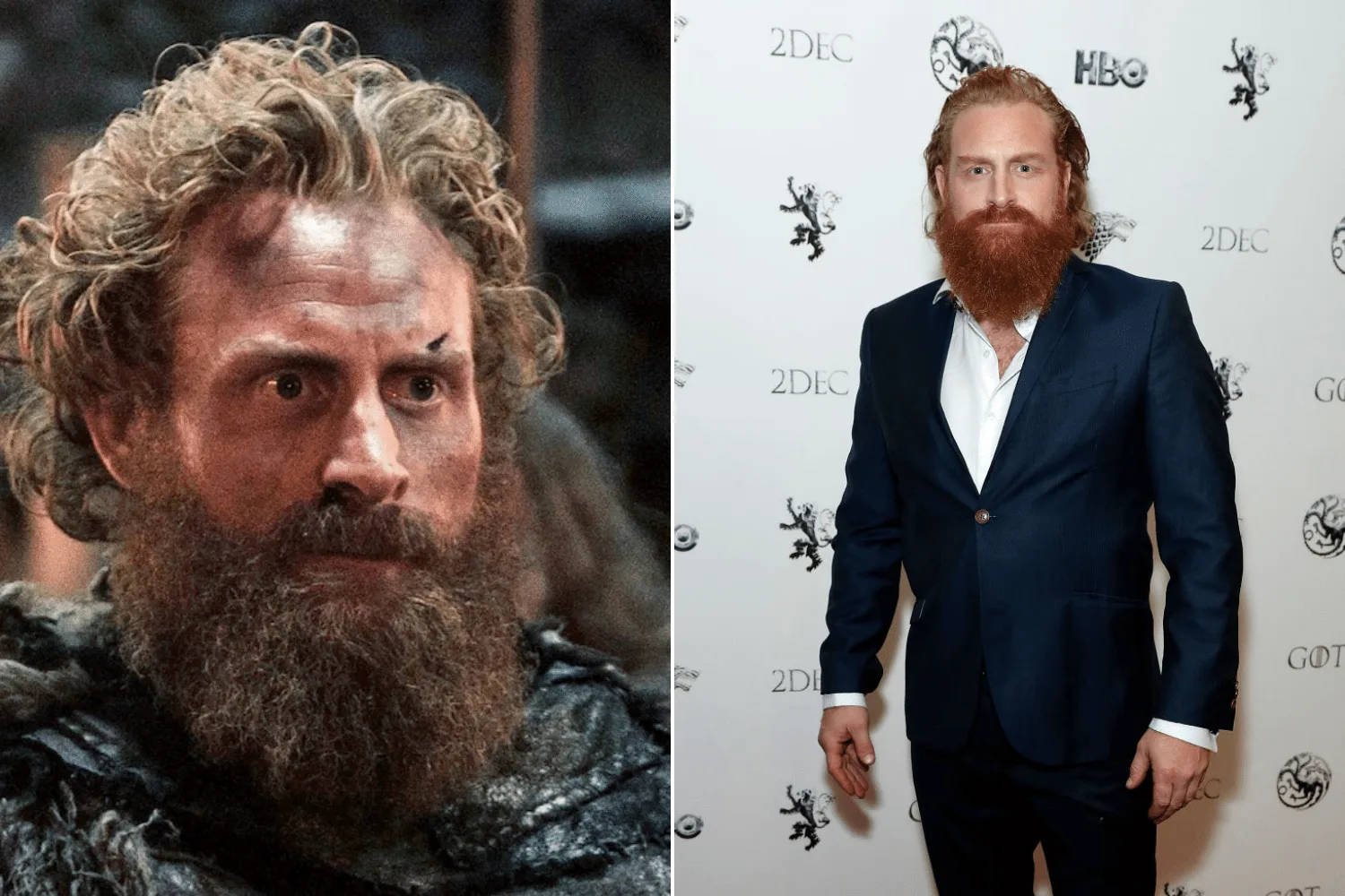 Kristofer Hivju