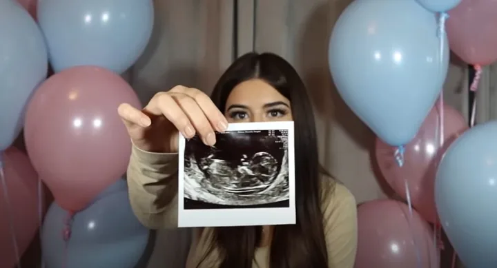 Suprise: Brownlee shares a sonogram of her growing baby from her recent ultrasound.