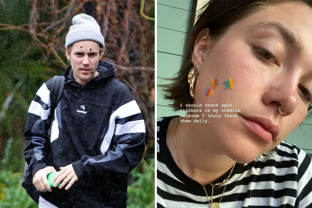 justin-bieber-florence-pugh-pimple-patches