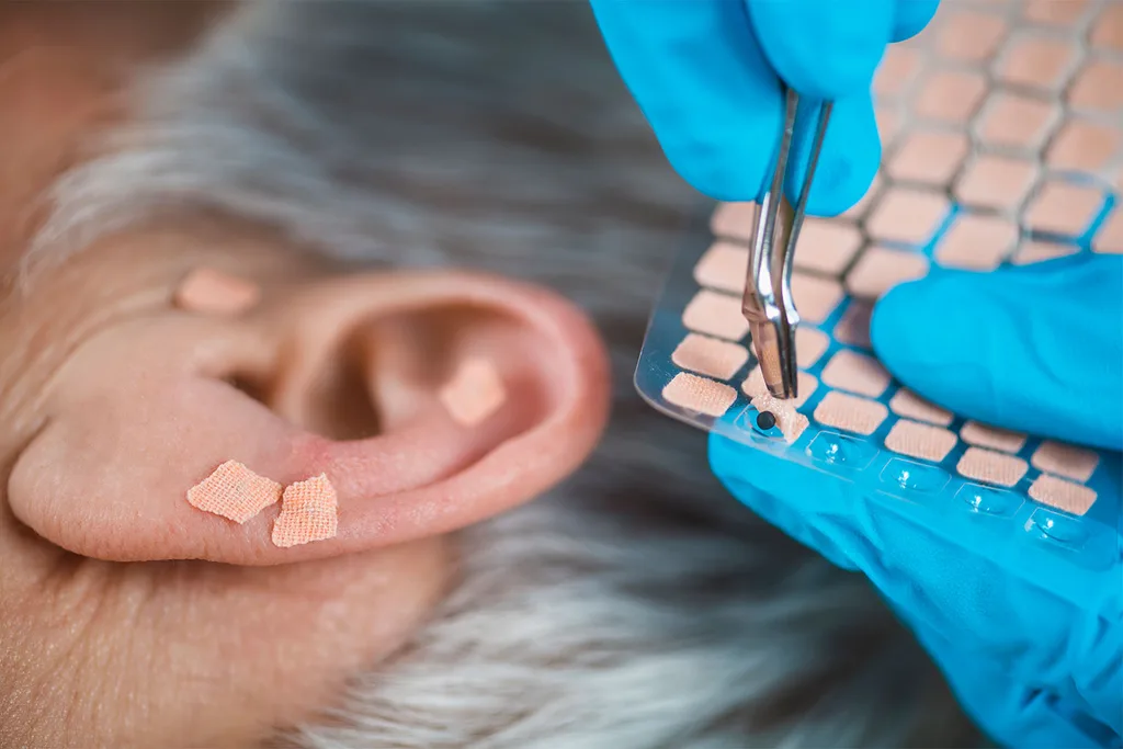 A-person-having-ear-seeds-which-look-like-tiny-squares-of-bandaids-being-placed-on-their-ear-pressure-points