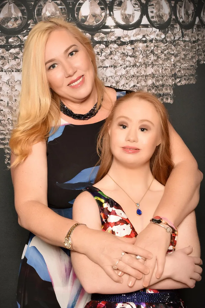 Madeline-stuart-posing-with-mother-Rosanne