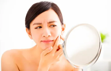 How To Treat Those Pesky Acne Scars
