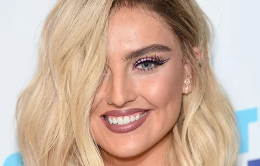 Perrie Edwards shows off a major scar on her stomach in new topless photo