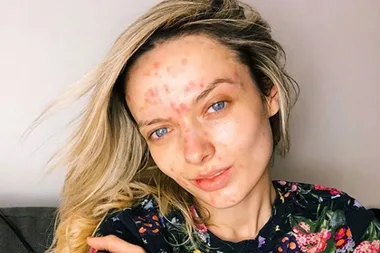 This woman was told there was something ‘wrong’ with her face
