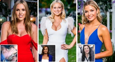 ‘The Bachelor’ plastic surgery secrets revealed!