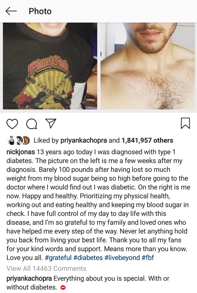 Nick Jonas