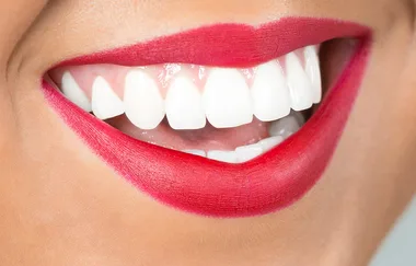 Make Your Teeth Whiter At Home With Just Two Simple Ingredients