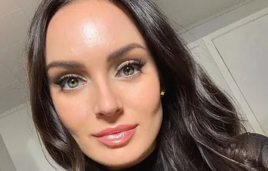 YouTube sensation Chloe Morello shares fantastic pimple tip