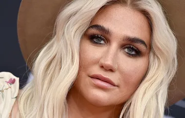 This natural photo of Kesha’s freckles has gone HAM online