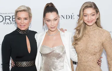 Yolanda Hadid talks about her daughters having botox and fillers