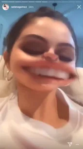 Selena Gomez slams Snapchat for only using blue eyes for the ‘pretty’ filters