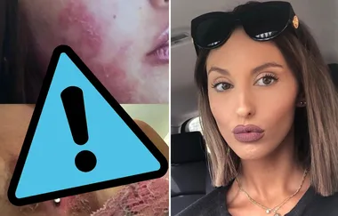 MAFS Elizabeth Sobinoff shows horrifying skin condition
