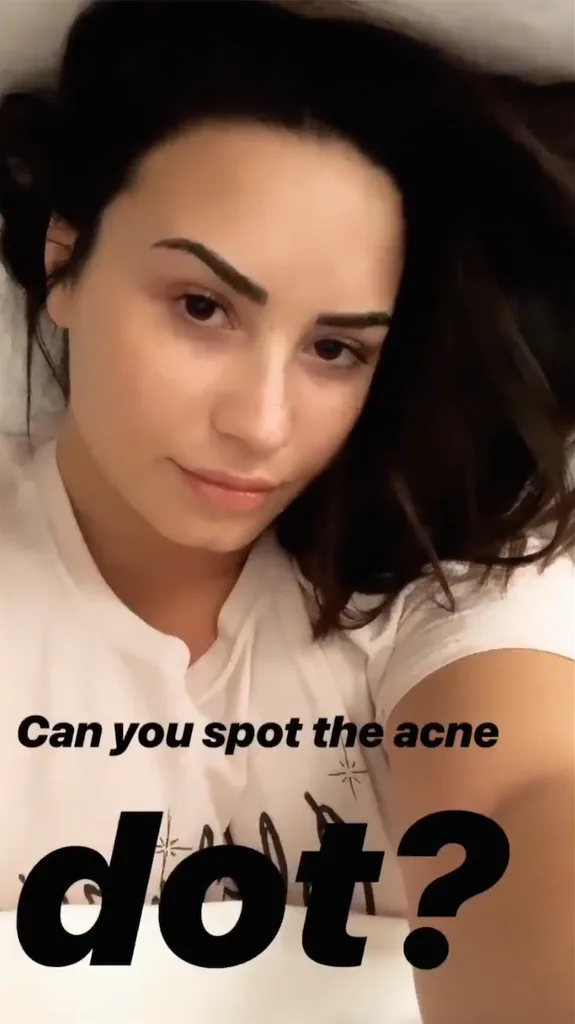 Demi Lovato