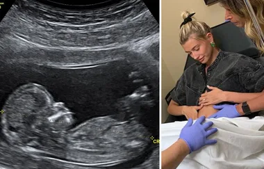 Everything to know about the Justin Bieber pregnancy prank that seriously backfired