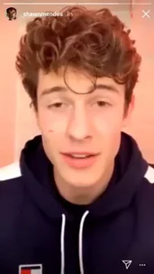 Shawn Mendes has a large cut on his face from a fan