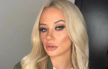 GRAPHIC CONTENT: MAFS Jessika’s gruesome lip filler video