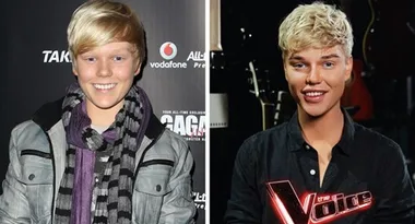 Jack Vidgen denies his plastic surgery