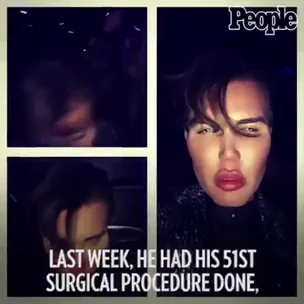 What ‘Human Ken Doll’ has spent on his 51 plastic surgery procedures