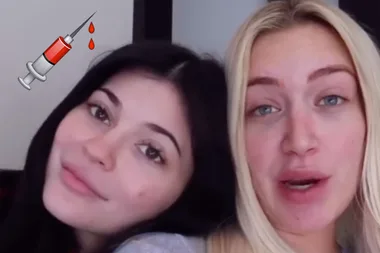 Kylie Jenner and her BFF got matching surgery