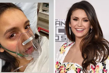 Nina Dobrev shares photos of swollen face after trip to hospital
