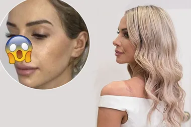 MAFS Stacey Hampton’s old nose has surfaced online