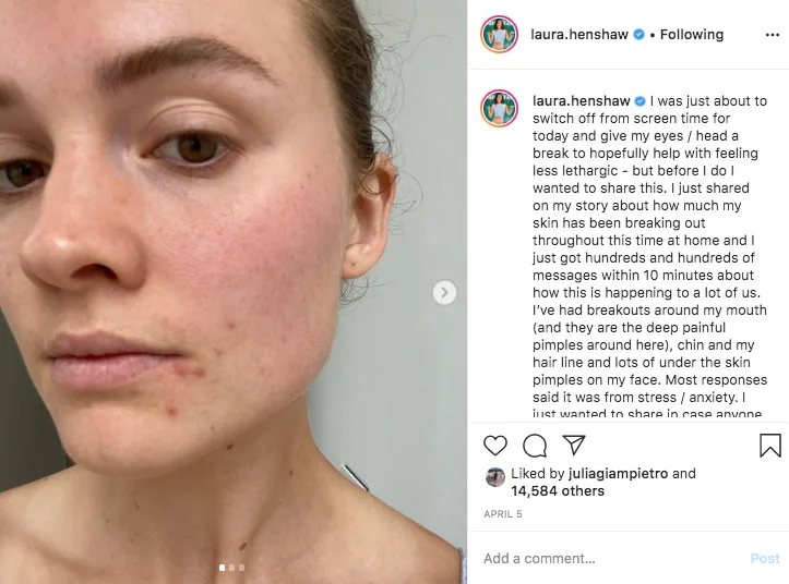 self iso breakouts