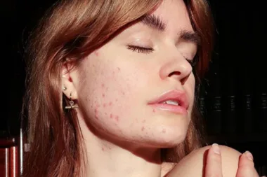 Is your skin freaking out right now? Here’s why