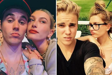 Hailey Bieber talks about her and husband Justin Biebers skin battles