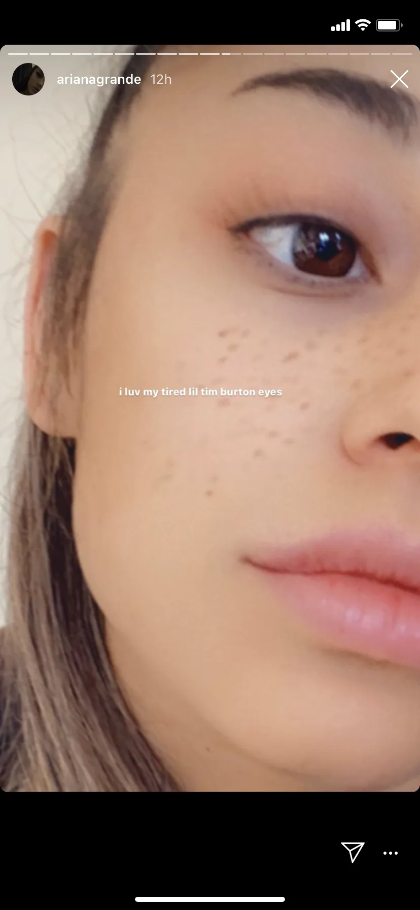 Ari donning a cheeky set of Instagram filter freckles and