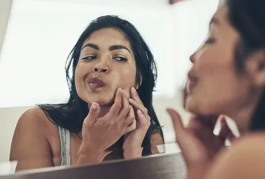 How Do Acne Patches Actually Work?