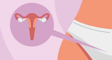 All Your Pap Smear Questions Answered