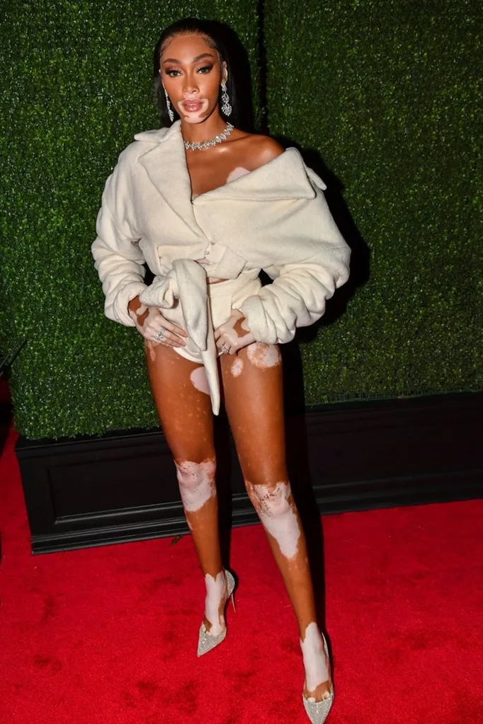 winnie-harlow-vmas-2021