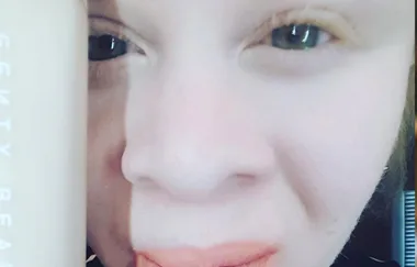 People With Albinism Are Praising The HECK Out Of Fenty Beauty And It’s So Heartwarming