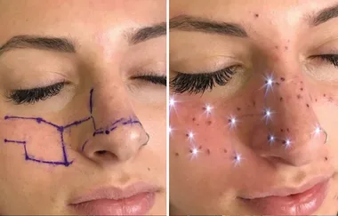 People Are Tattooing Their Astrological Sign Onto Their Face As Freckles
