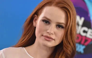 Redheads Supposedly Have “Genetic Superpowers”