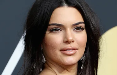 Kendall Jenner Shows Off Her Acne Again And We’re Still Obsessed