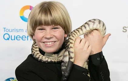 Robert Irwin Rushed To Hospital | Girlfriend