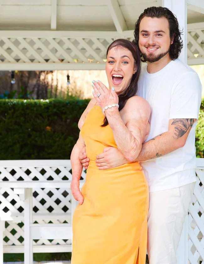 Couple embracing happily, woman in yellow dress showing engagement ring, standing under a white gazebo.