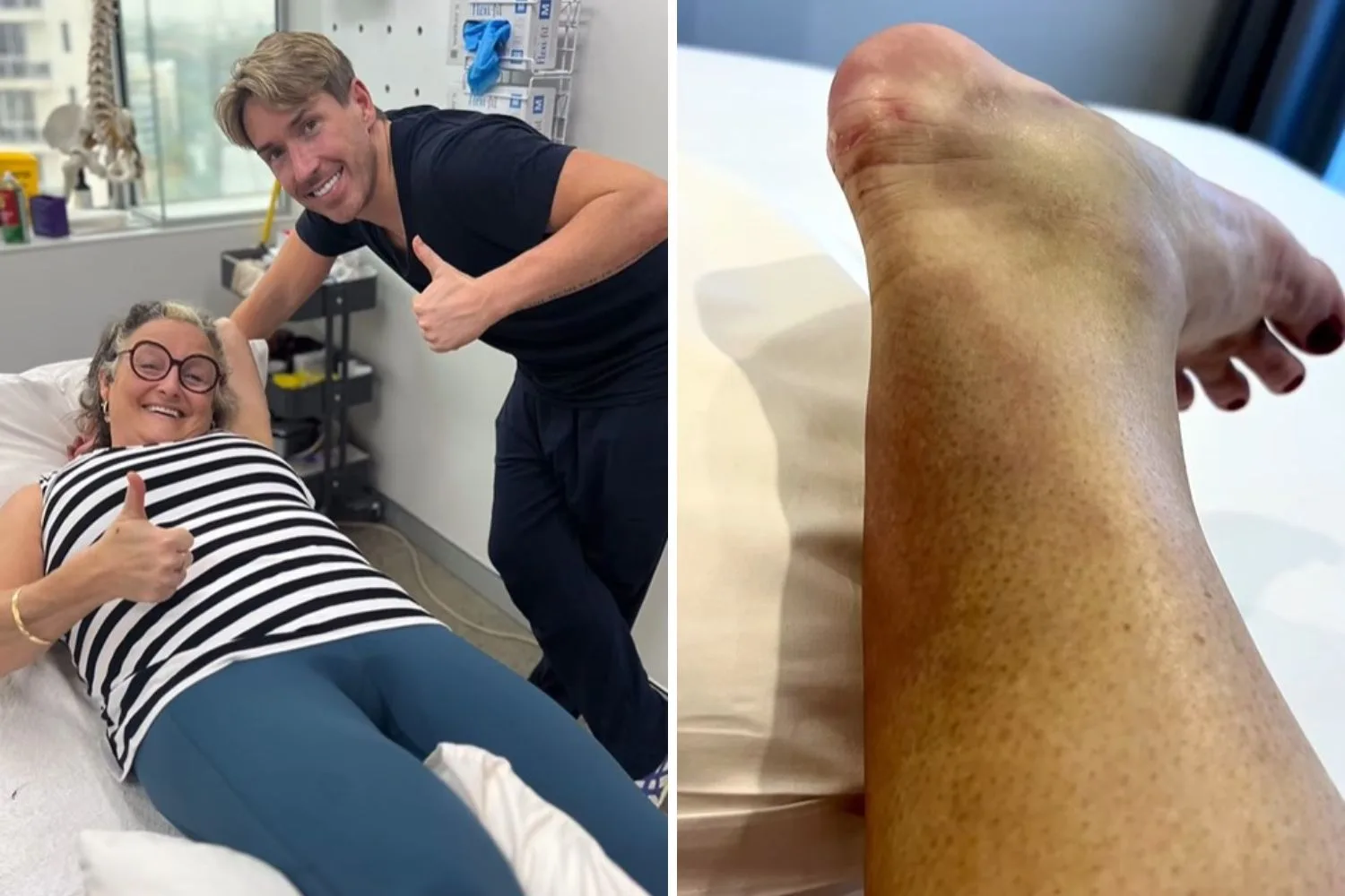 julie goodwin lying in hospital as she is treated for her calf injury