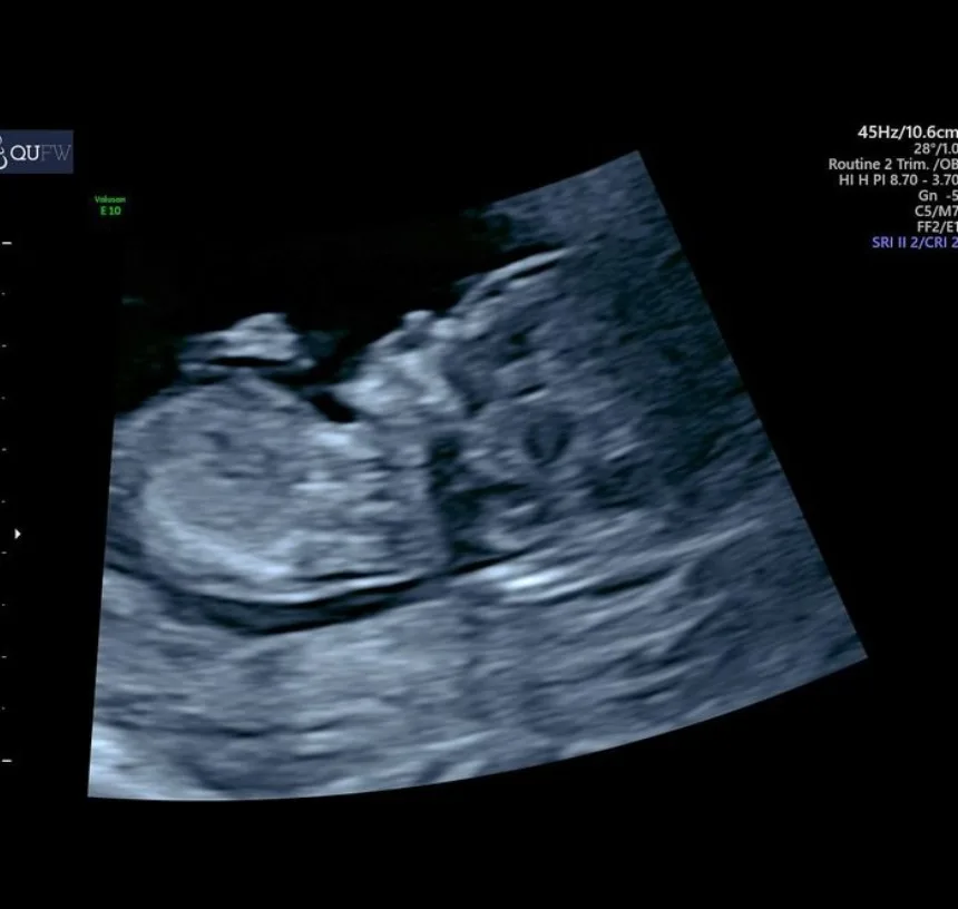 libby trickett pregnant