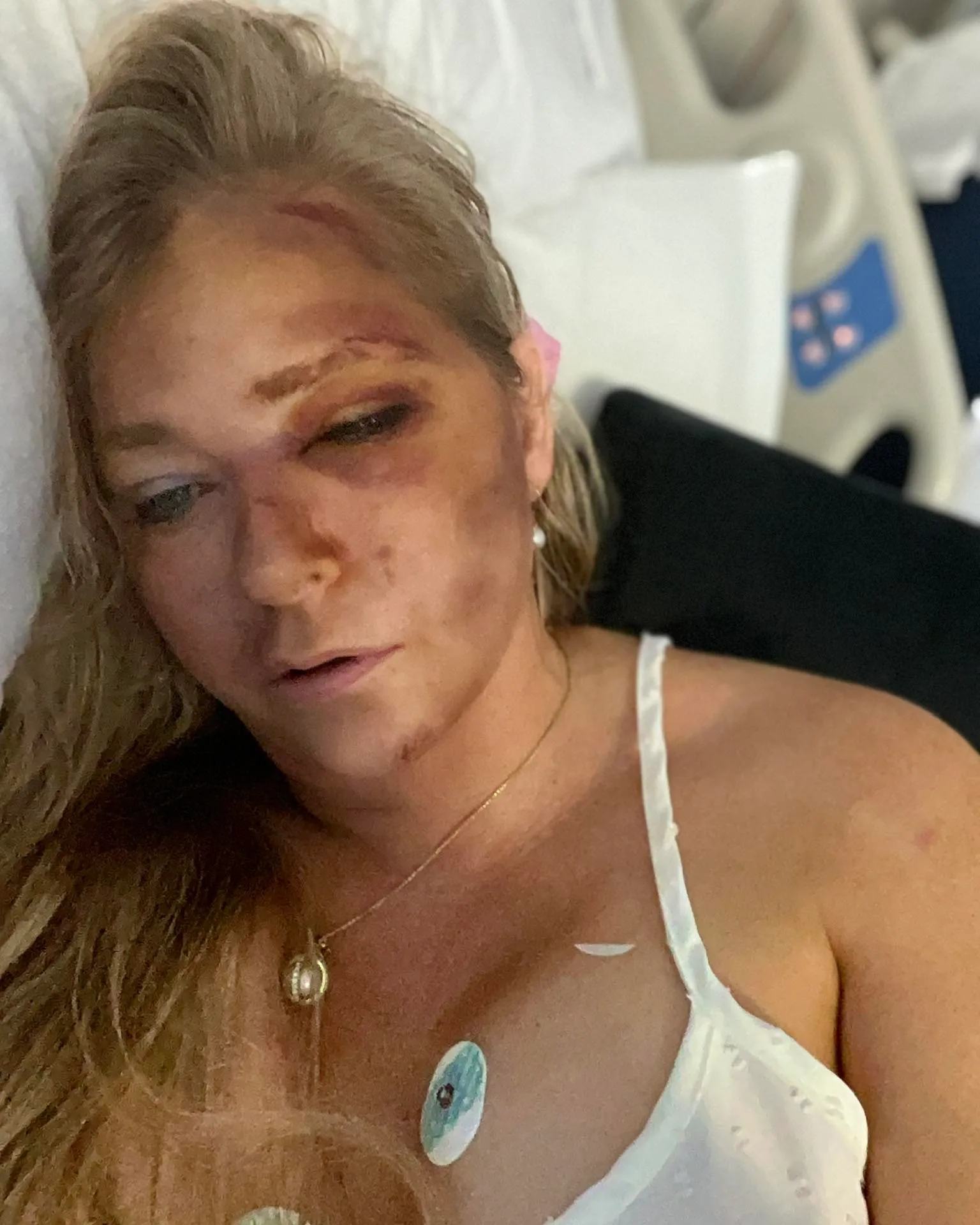 Virginia Giuffre accident