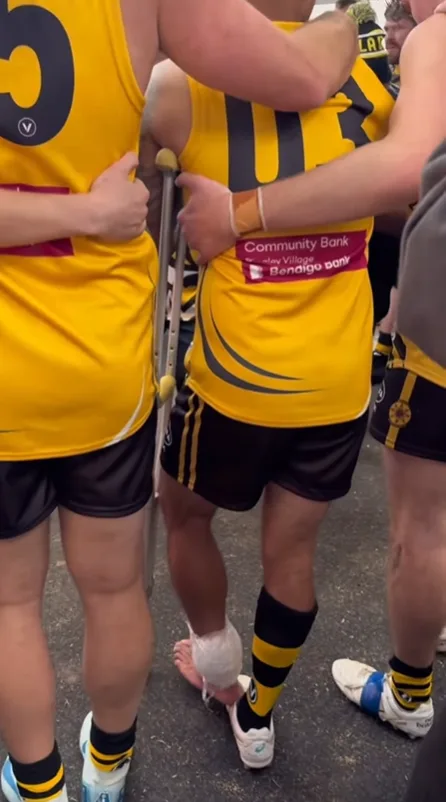 Guy Sebastian crutches after AFL game