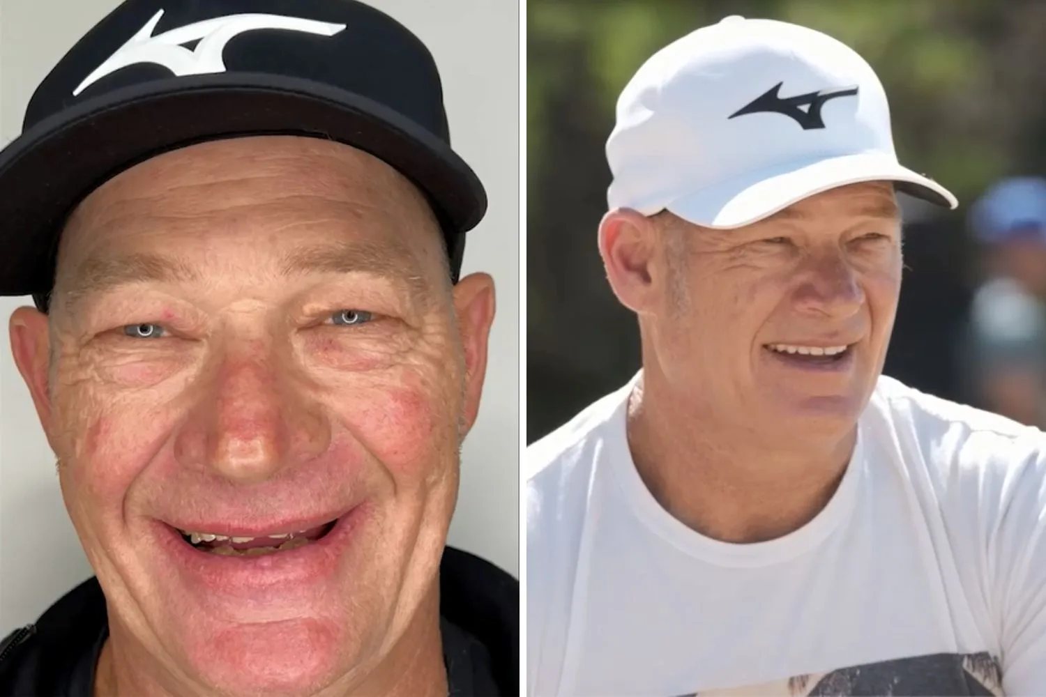 Before and after photos of Foreman Keith before his dental tranformation and afterwards
