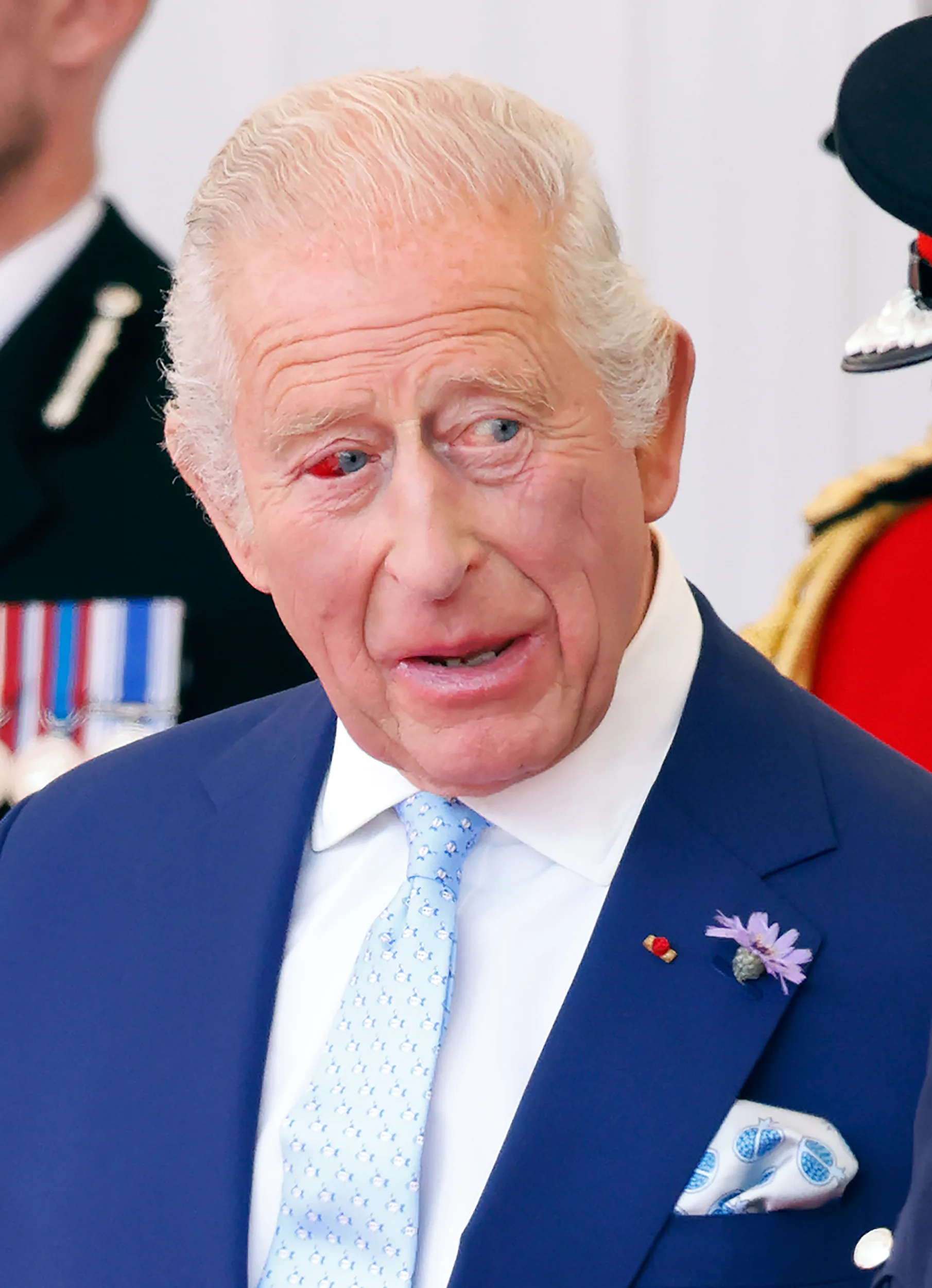 King Charles eye 