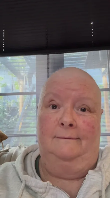 Magda Szubanski cancer health update