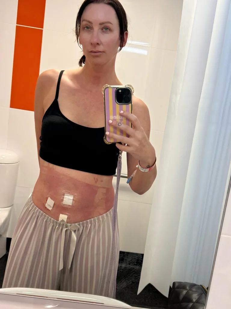 Isabelle Silbery emergency surgery Gogglebox