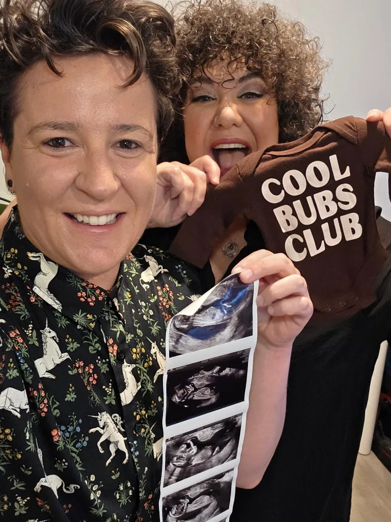 Casey Donovan and her fiancee Renee Sharples revealing their pregnancy news