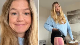 &ldquo;Quite a few tears&rdquo;: Shark attack survivor Leah Stewart shares &ldquo;devastating&rdquo; health update