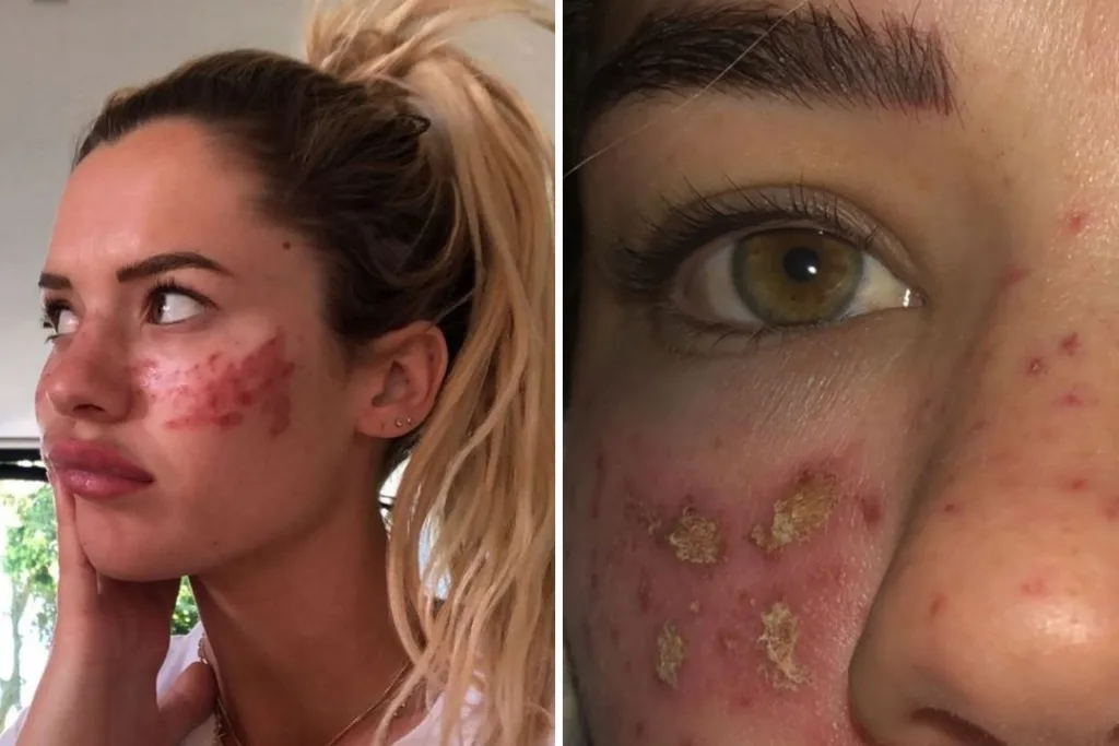 big brother tilly skin