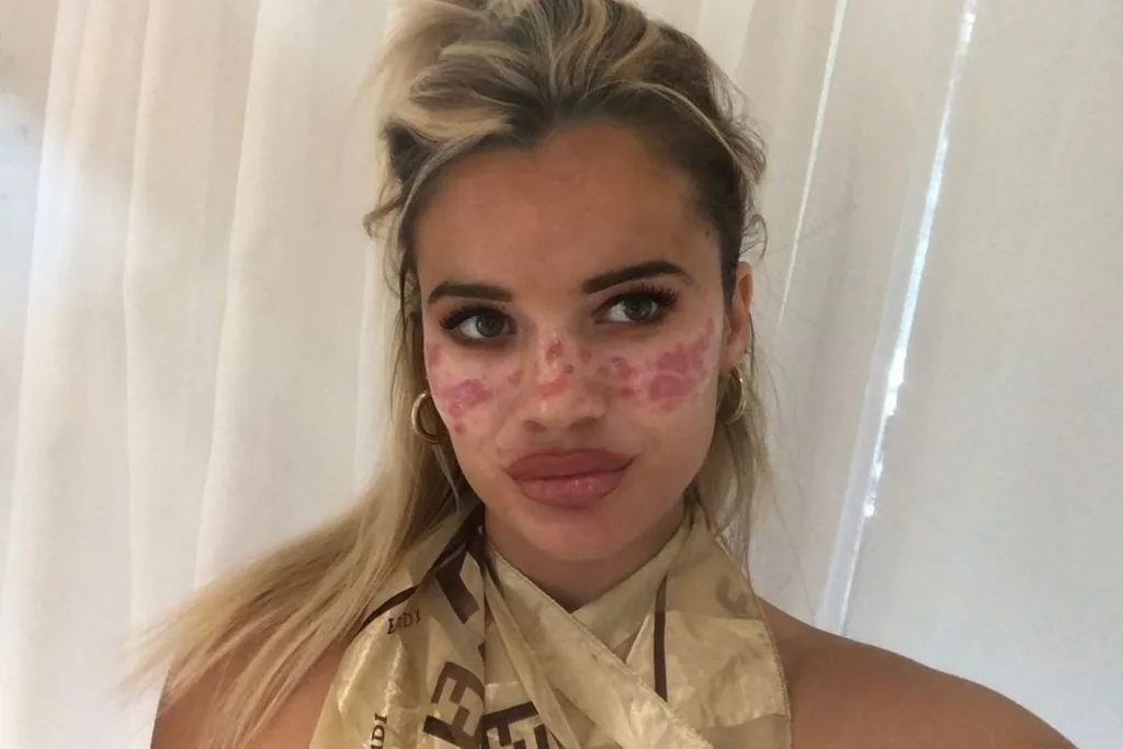 big brother tilly skin